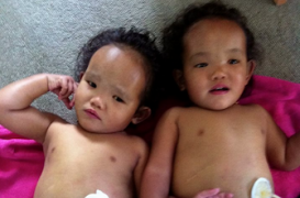 Greffe de foie : un papa canadien face à un terrible dilemme